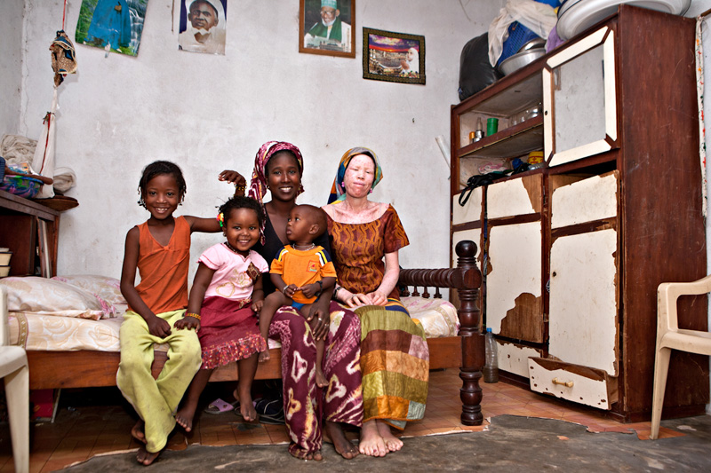 Casa África muestra la realidad de la vida de los albinos en Senegal con una exposición fotográfica