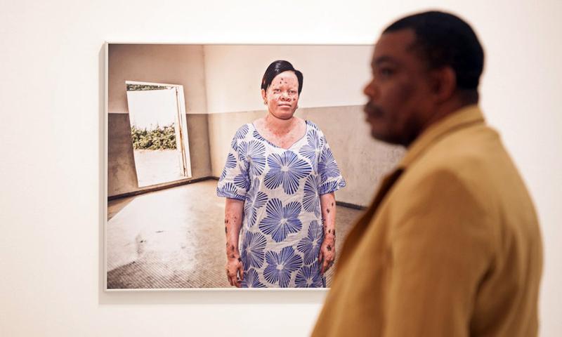 Casa África muestra la realidad de la vida de los albinos en Senegal con una exposición fotográfica