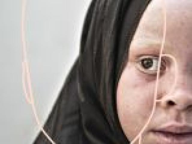 Albino, bajo la sombra del sol, Ana Yturralde