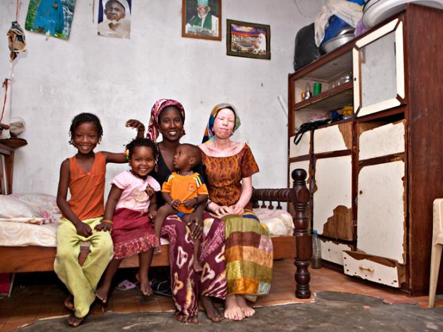 Casa África muestra la realidad de la vida de los albinos en Senegal con una exposición fotográfica