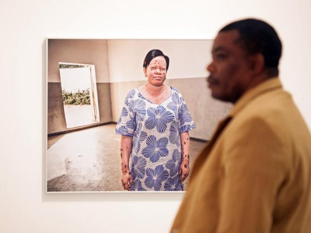 Casa África muestra la realidad de la vida de los albinos en Senegal con una exposición fotográfica