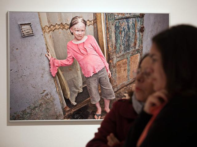 Casa África muestra la realidad de la vida de los albinos en Senegal con una exposición fotográfica