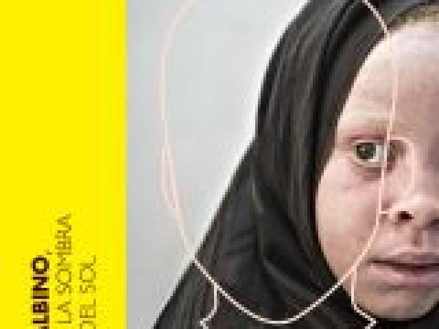 "Albino, bajo la sombra del sol" llega a La Habana, Cuba